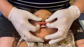 上唇小帯の横を優しく伸ばして柔らかくしましょう
